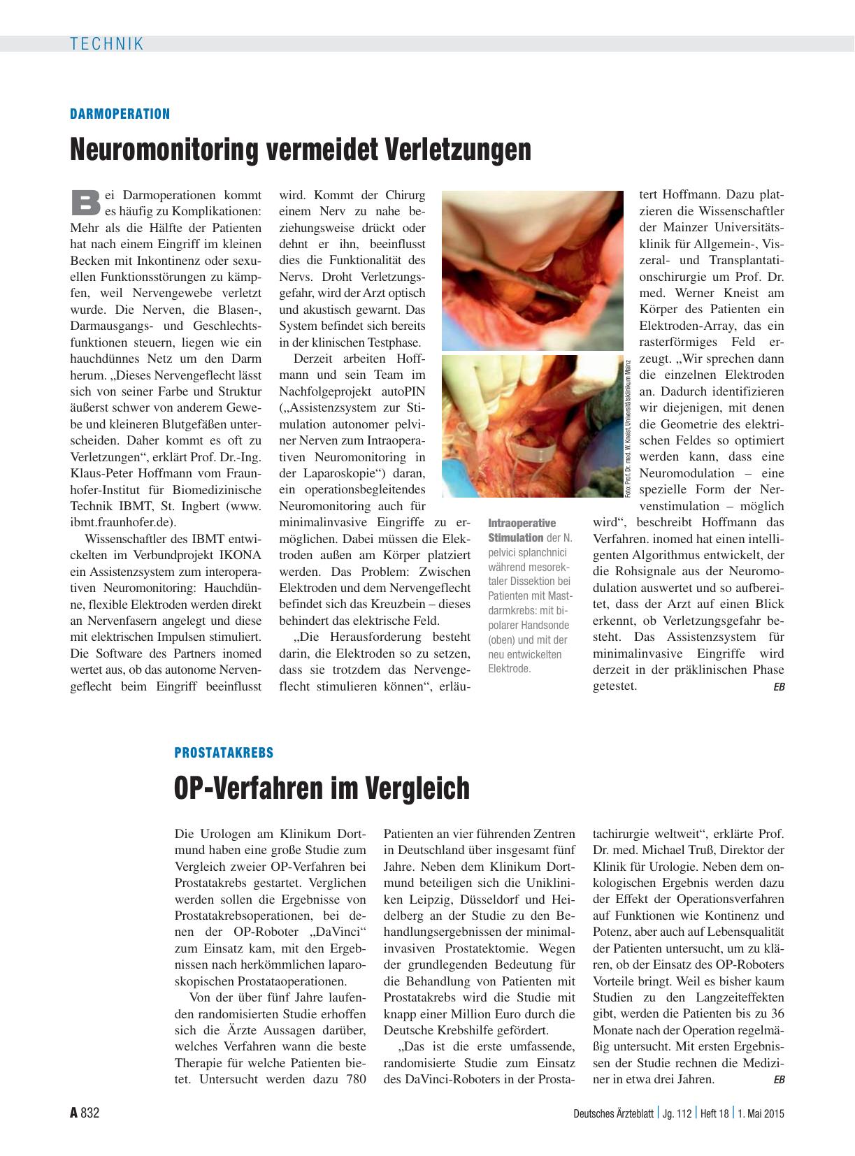 Vorschauseite 1: Prostatakrebs: OP-Verfahren im Vergleich