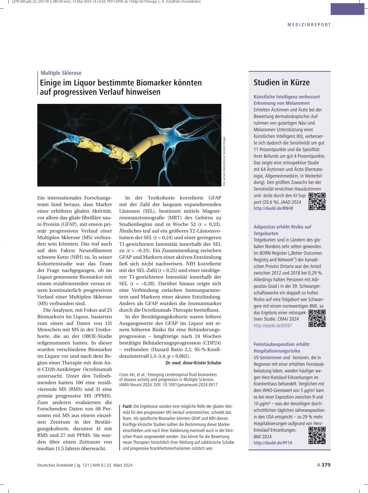 Vorschauseite 1: Multiple Sklerose: Einige im Liquor bestimmte Biomarker könnten auf progressiven Verlauf hinweisen.