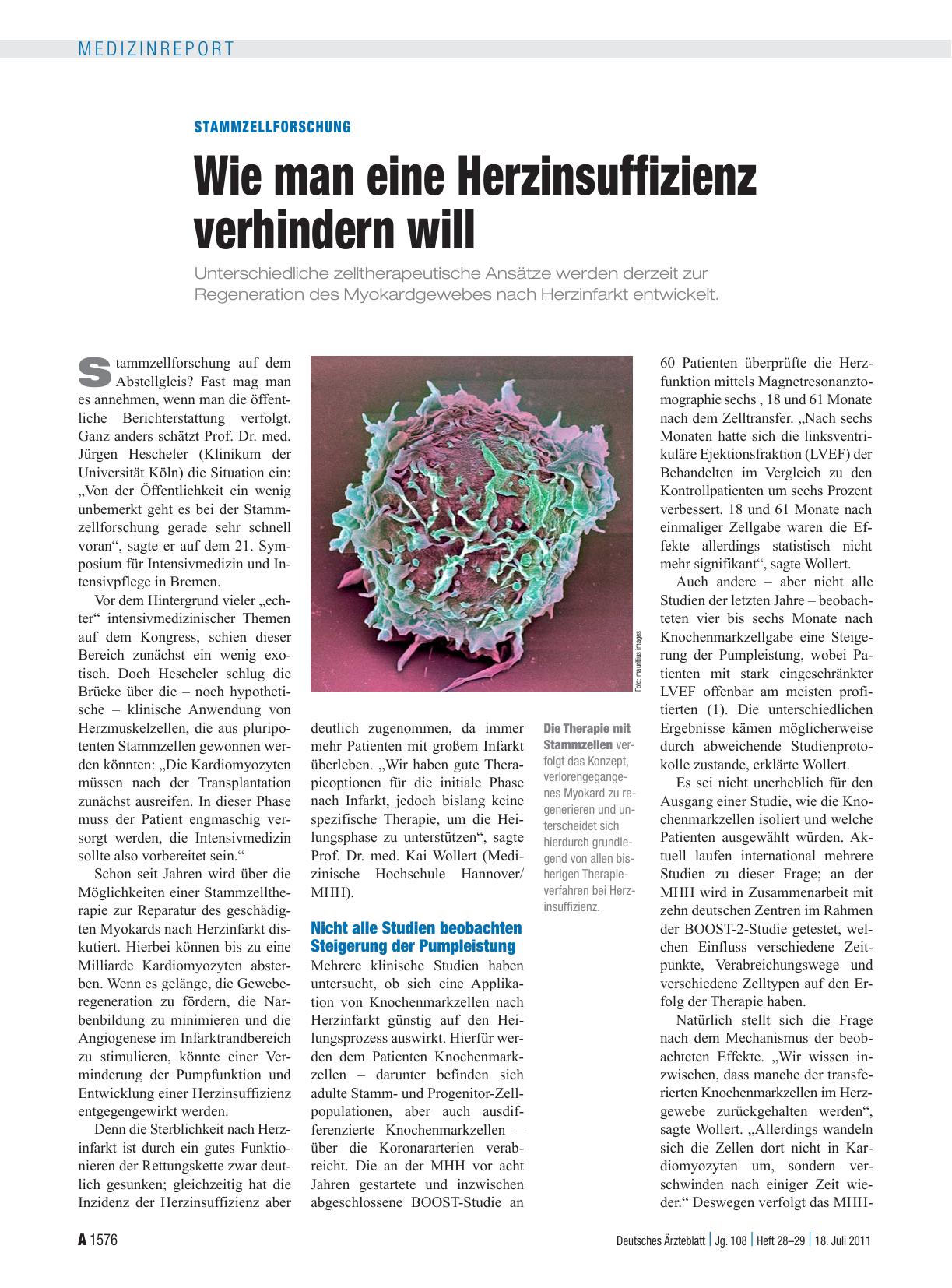 Vorschauseite 1: Stammzellforschung: Wie man eine Herzinsuffizienz verhindern will