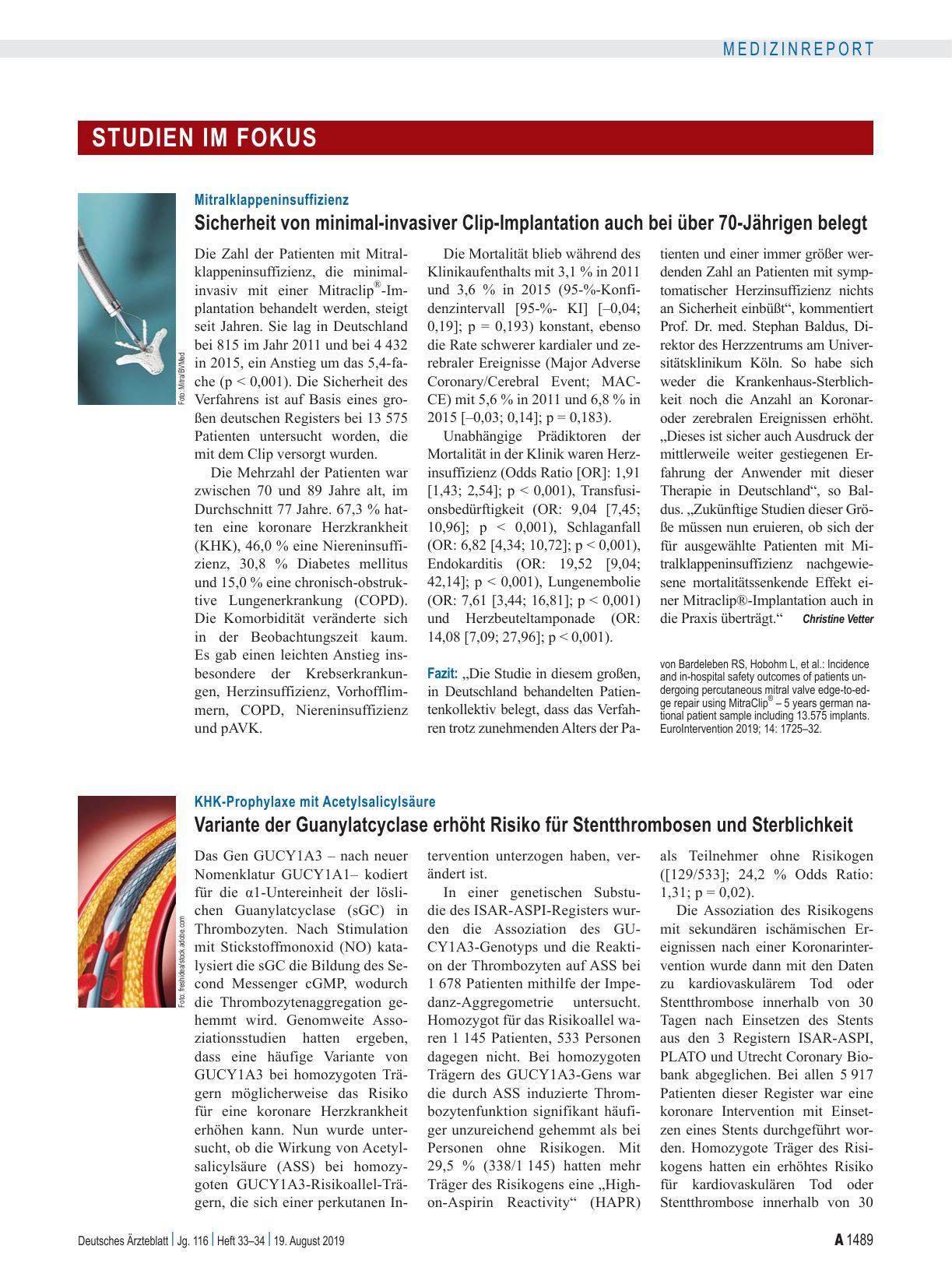 Vorschauseite 1: Mitralklappeninsuffizienz: Sicherheit von minimal-invasiver Clip-Implantation auch bei über 70-Jährigen belegt