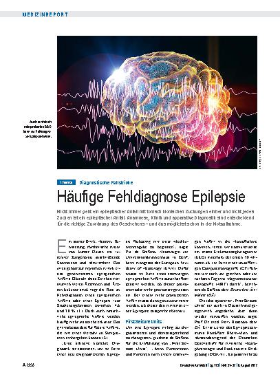 Vorschauseite 1: Diagnostische Fallstricke: Häufige Fehldiagnose Epilepsie