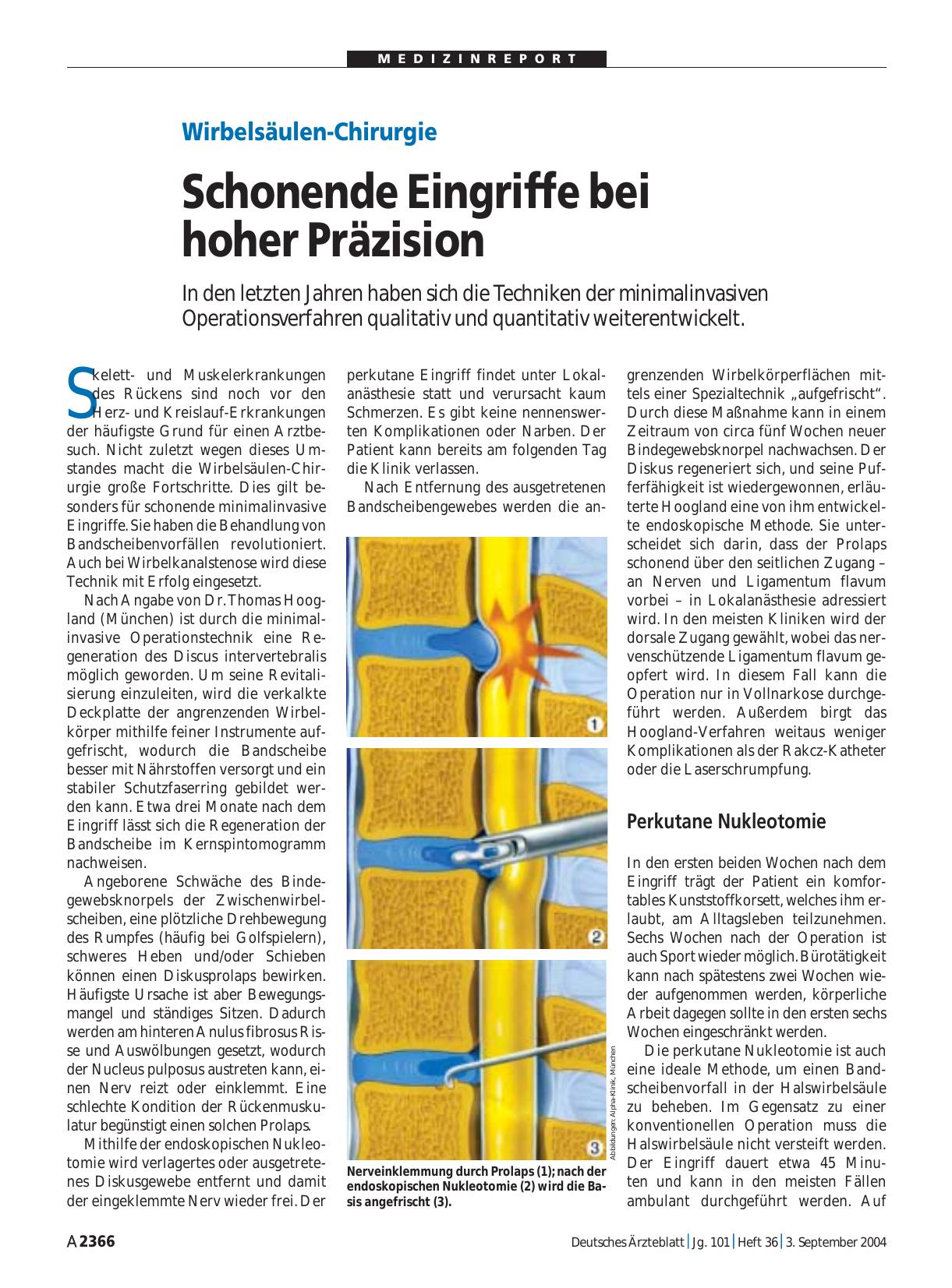 Vorschauseite 1: Wirbelsäulen-Chirurgie: Schonende Eingriffe bei hoher Präzision