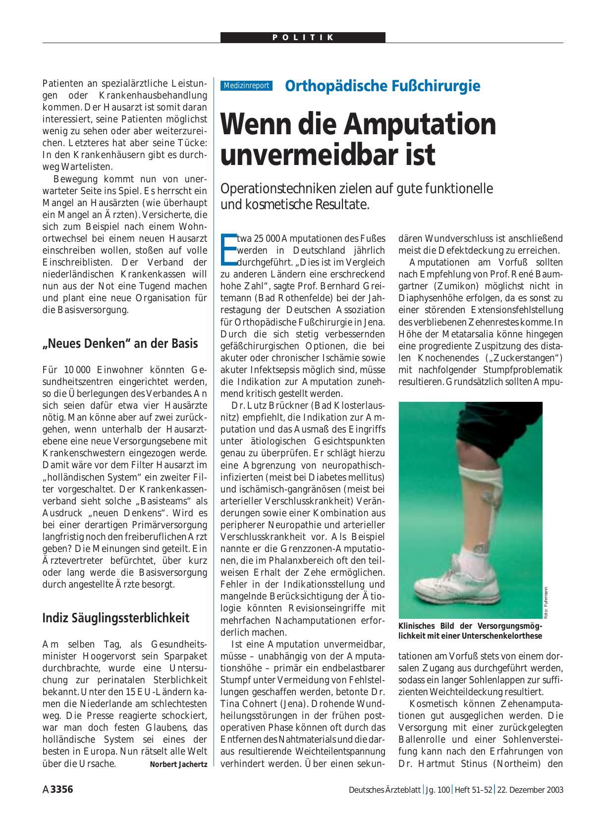 Vorschauseite 1: Orthopädische Fußchirurgie: Wenn die Amputation unvermeidbar ist