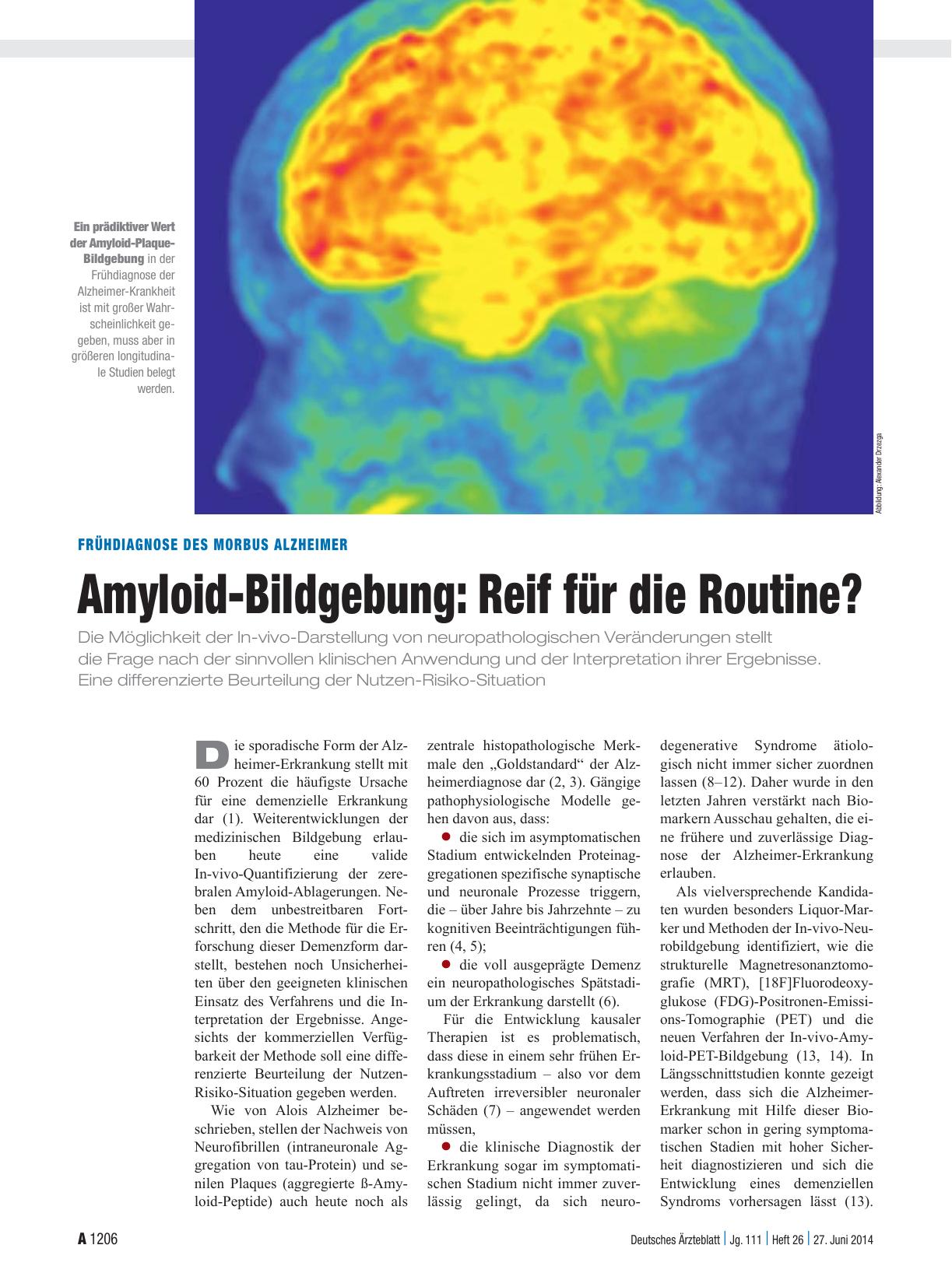 Vorschauseite 1: Frühdiagnose des Morbus Alzheimer: Amyloid-Bildgebung – Reif für die Routine?