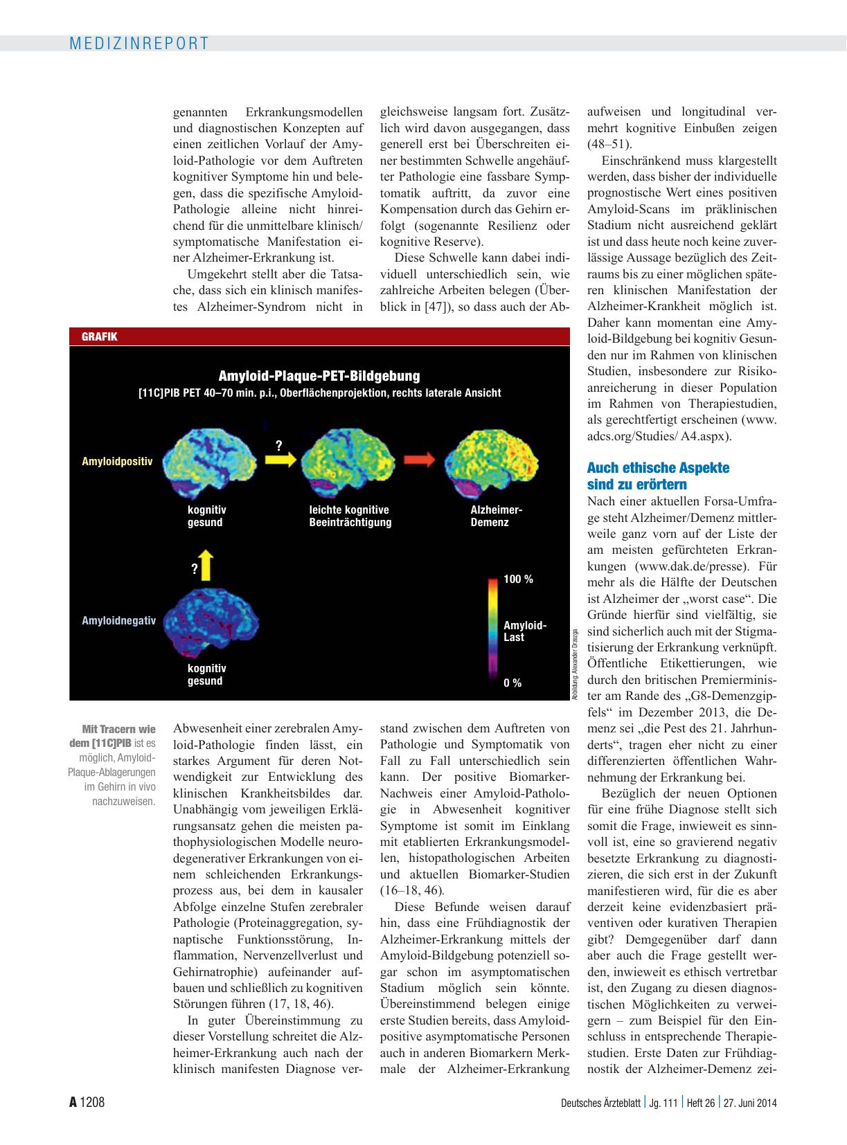 Vorschauseite 3: Frühdiagnose des Morbus Alzheimer: Amyloid-Bildgebung – Reif für die Routine?