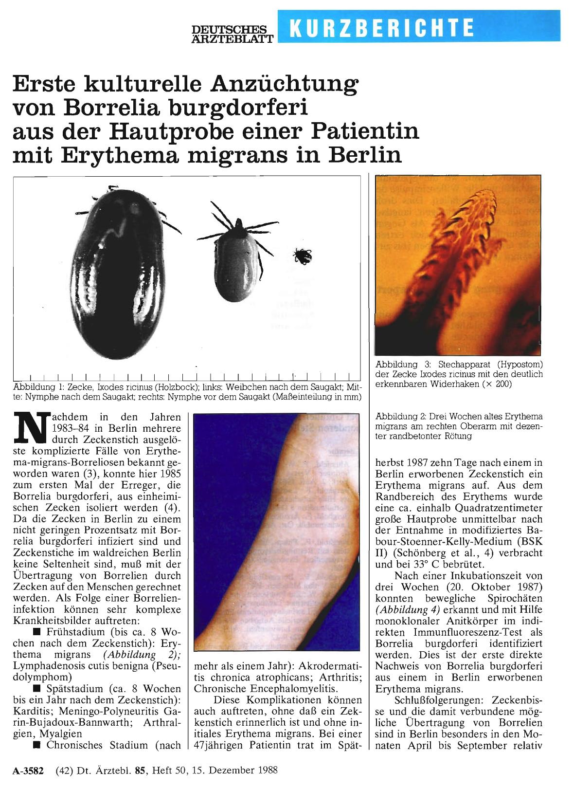 Vorschauseite 1: Erste kulturelle Anzüchtung von Borrelia burgdorferi aus der Hautprobe einer Patientin mit Erythema migrans in Berlin