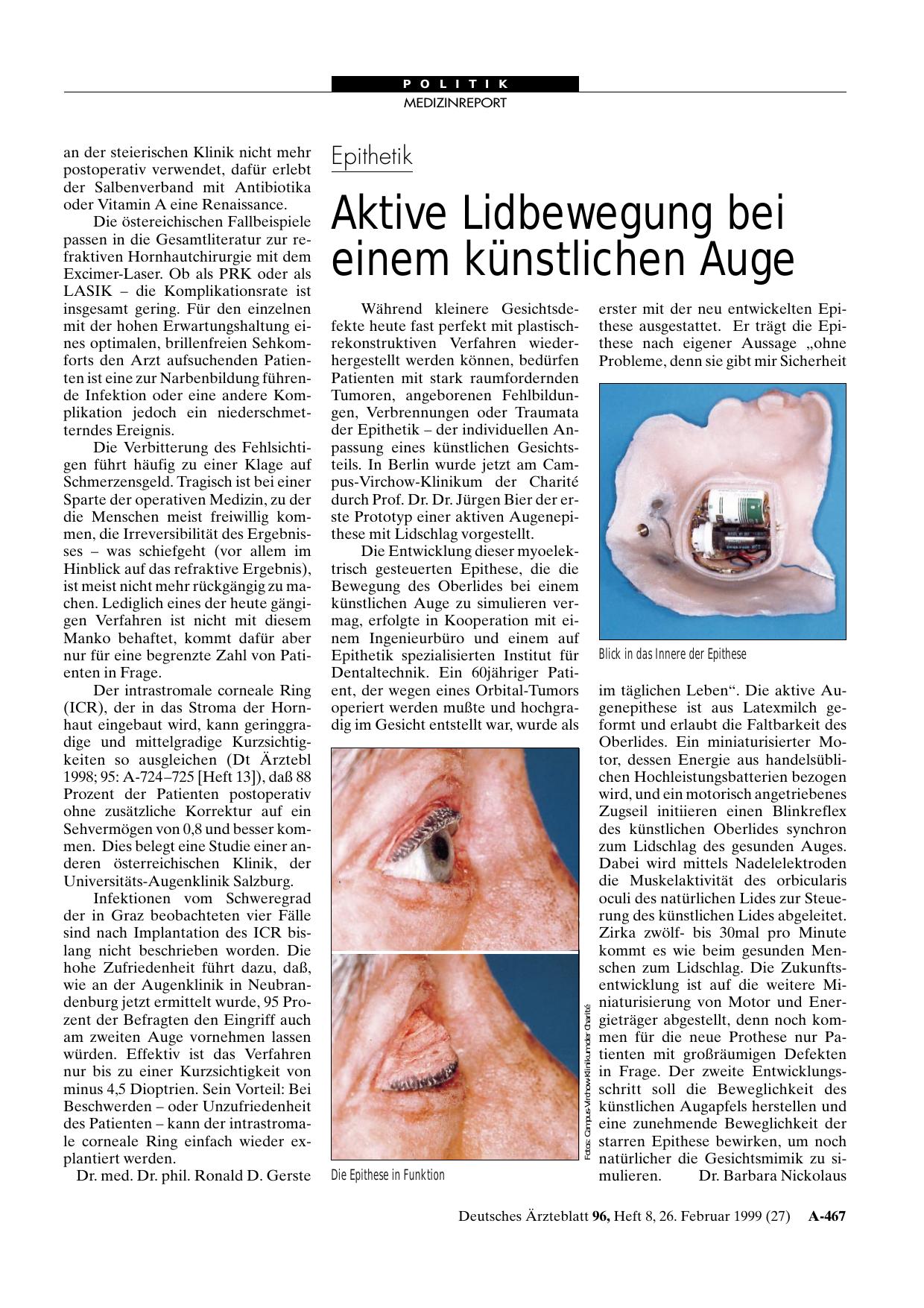 Vorschauseite 1: Epithetik: Aktive Lidbewegung bei einem künstlichen Auge