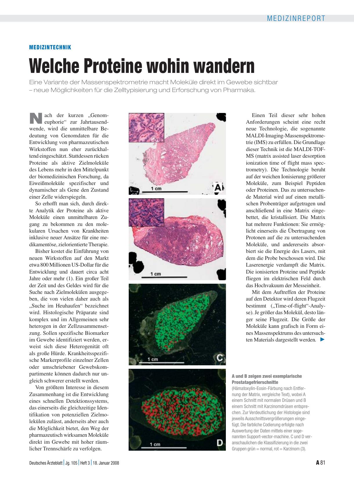 Vorschauseite 1: Medizintechnik: Welche Proteine wohin wandern