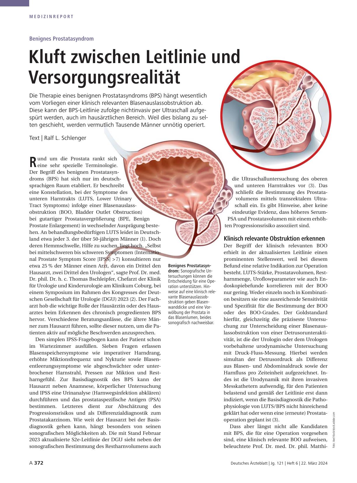 Vorschauseite 1: Benignes Prostata-Syndrom: Kluft zwischen Leitlinie und Versorgungsrealität