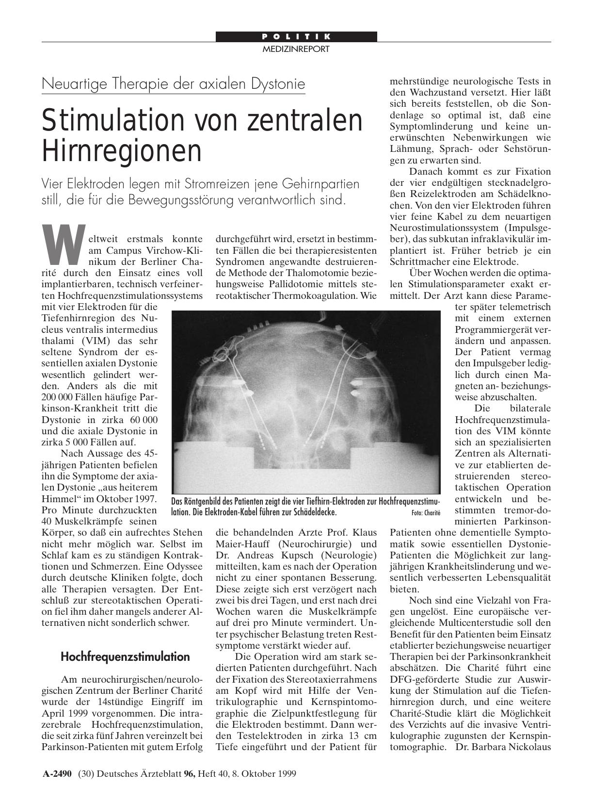Vorschauseite 1: Neuartige Therapie der axialen Dystonie: Stimulation von zentralen Hirnregionen