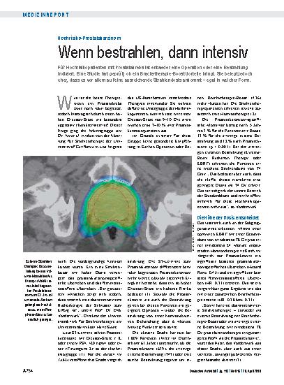 Vorschauseite 1: Hochrisiko-Prostatakarzinom: Wenn bestrahlen, dann intensiv