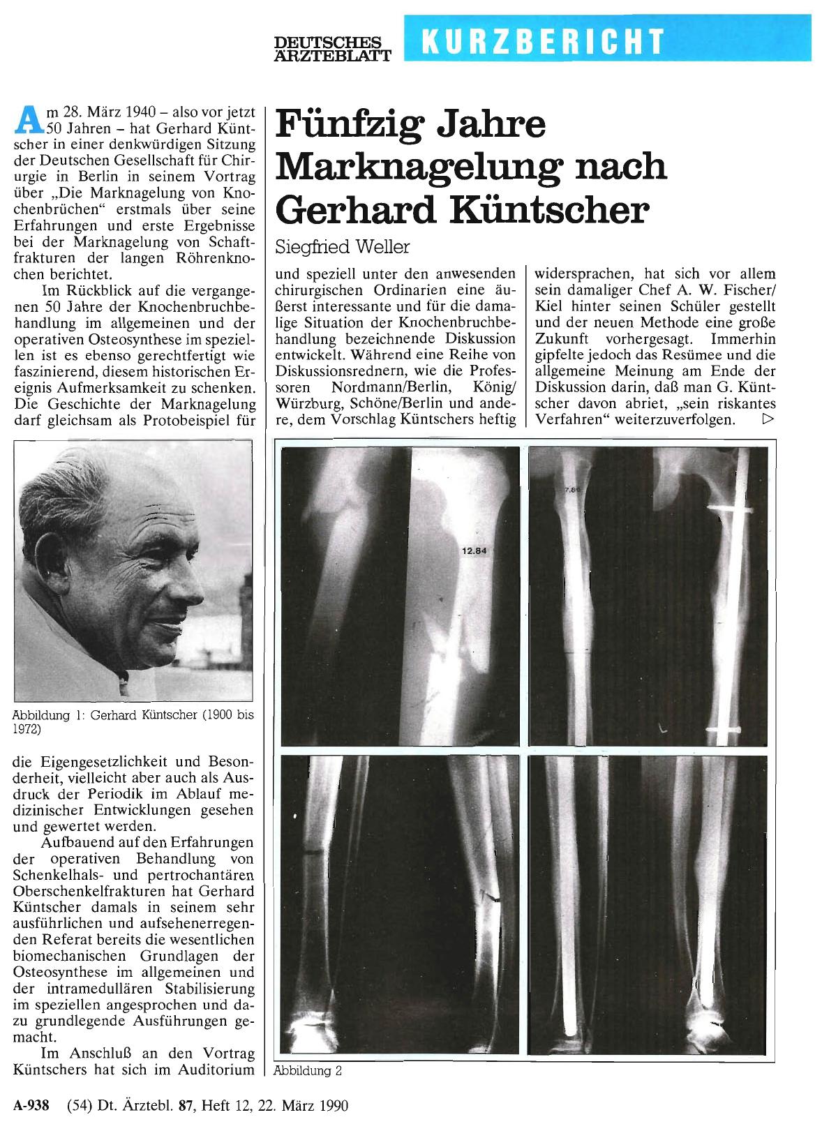Vorschauseite 1: Fünfzig Jahre Marknagelung nach Gerhard Küntscher