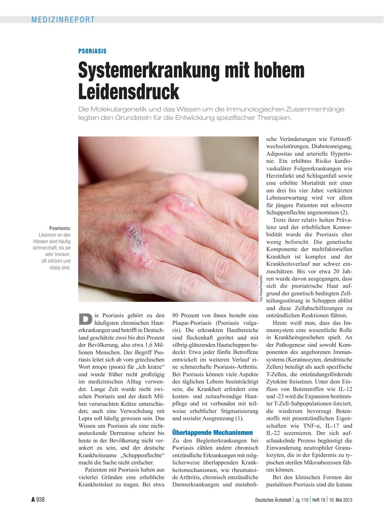 Vorschauseite 1: Psoriasis: Systemerkrankung mit hohem Leidensdruck