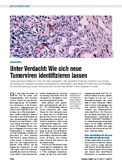 Vorschauseite 1: Onkogenese: Unter Verdacht – Wie sich neue Tumorviren identifizieren lassen