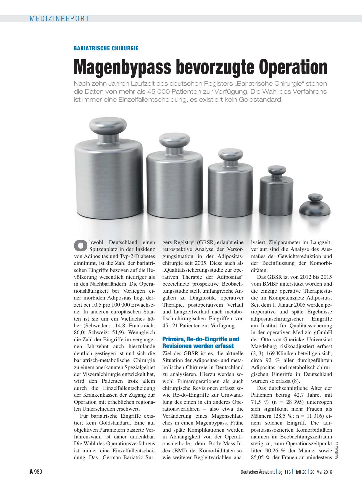 Vorschauseite 1: Bariatrische Chirurgie: Magenbypass bevorzugte Operation