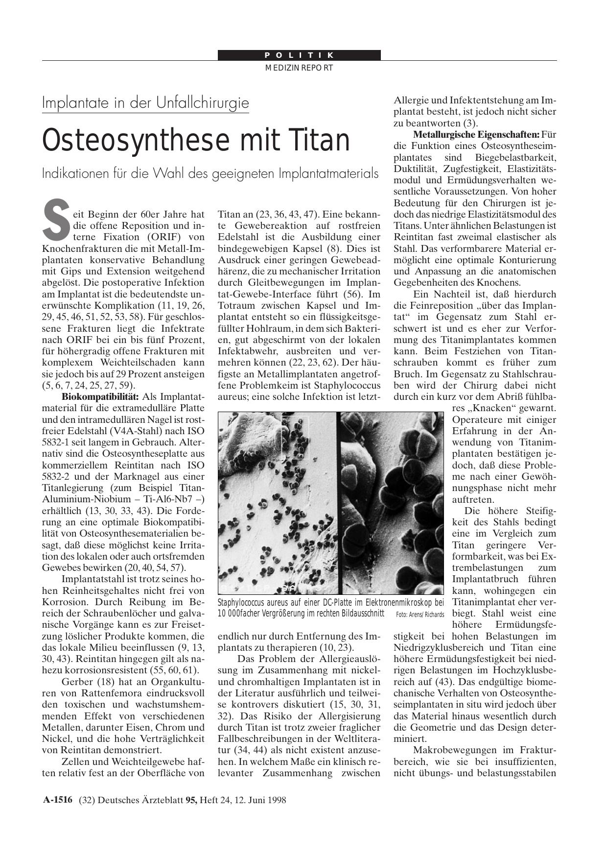 Vorschauseite 1: Implantate in der Unfallchirurgie: Osteosynthese mit Titan