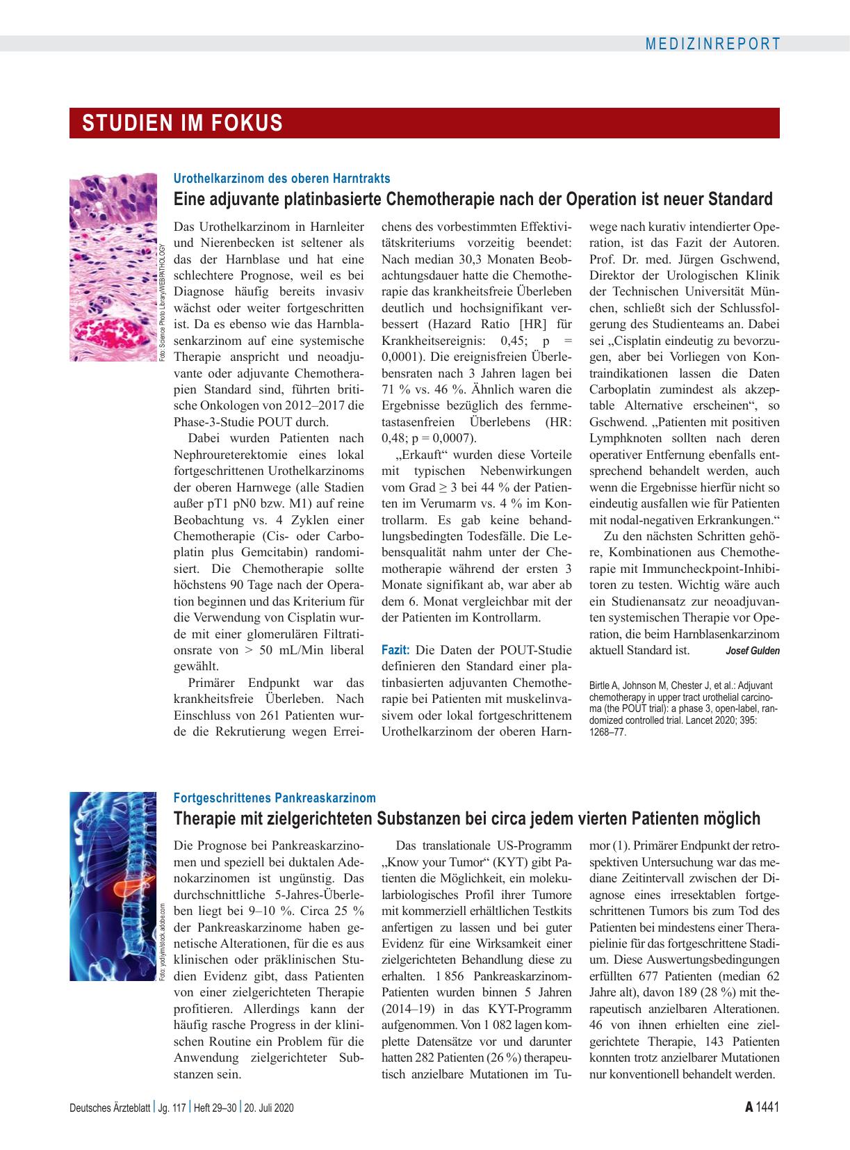 Vorschauseite 1: Urothelkarzinom des oberen Harntrakts: Eine adjuvante platinbasierte Chemotherapie nach der Operation ist neuer Standard