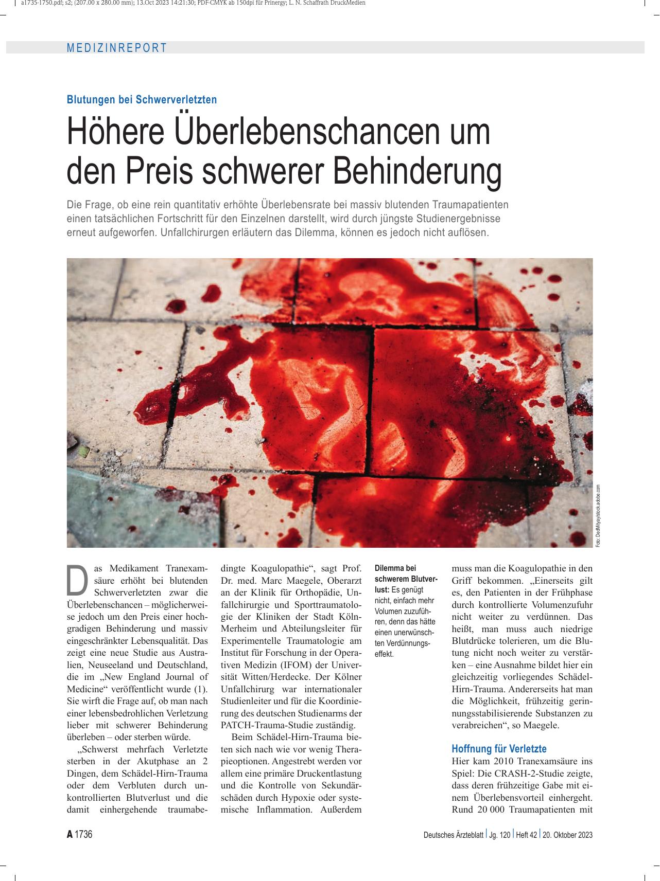 Vorschauseite 1: Blutungen bei Schwerverletzten: Höhere Überlebenschancen um den Preis schwerer Behinderung