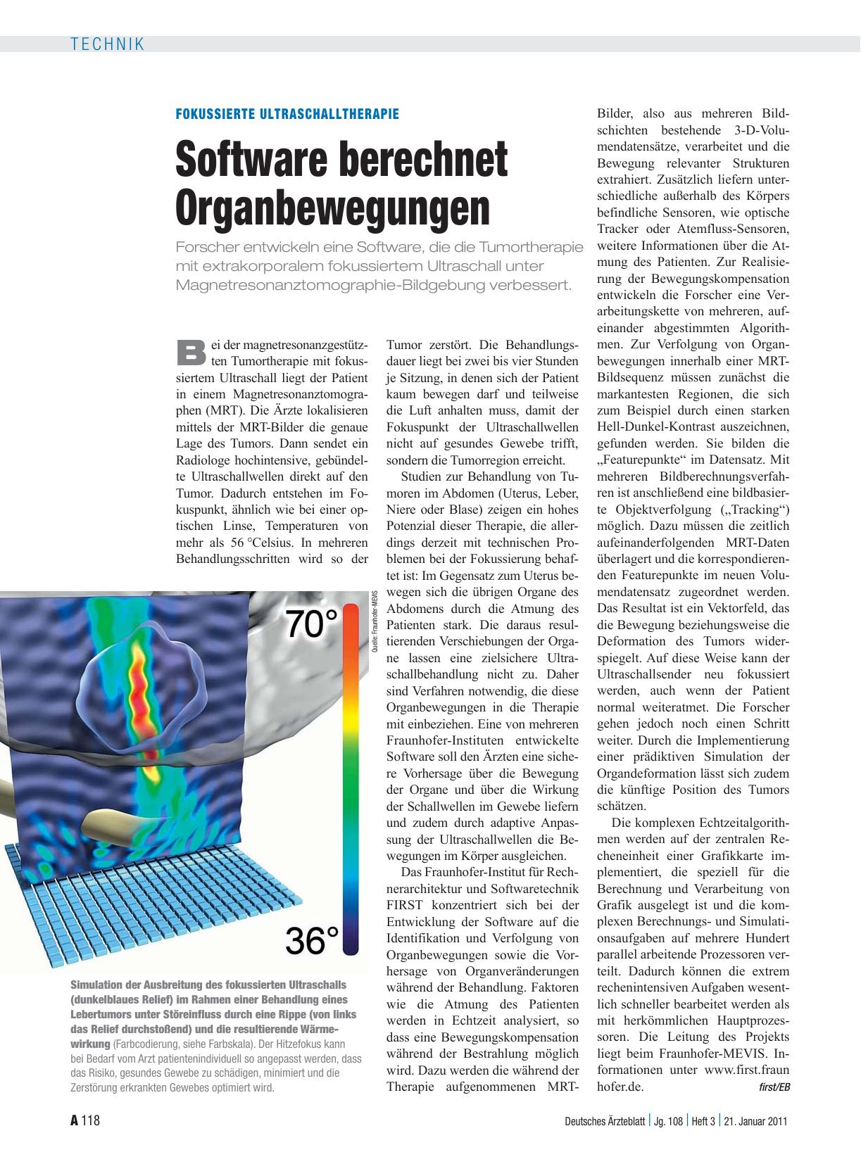 Vorschauseite 1: Fokussierte Ultraschalltherapie: Software berechnet Organbewegungen