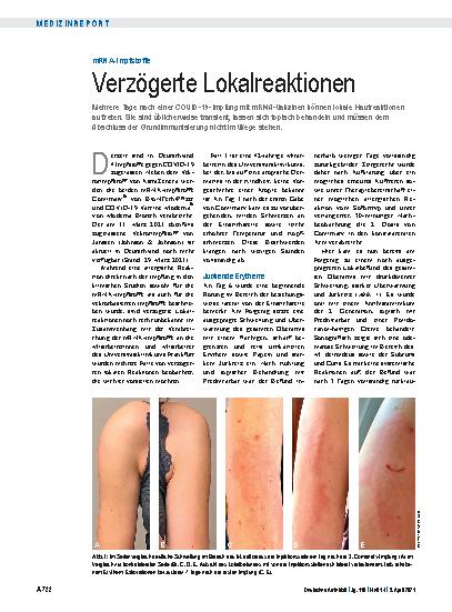 Vorschauseite 1: mRNA-Impfstoffe: Verzögerte Lokalreaktionen