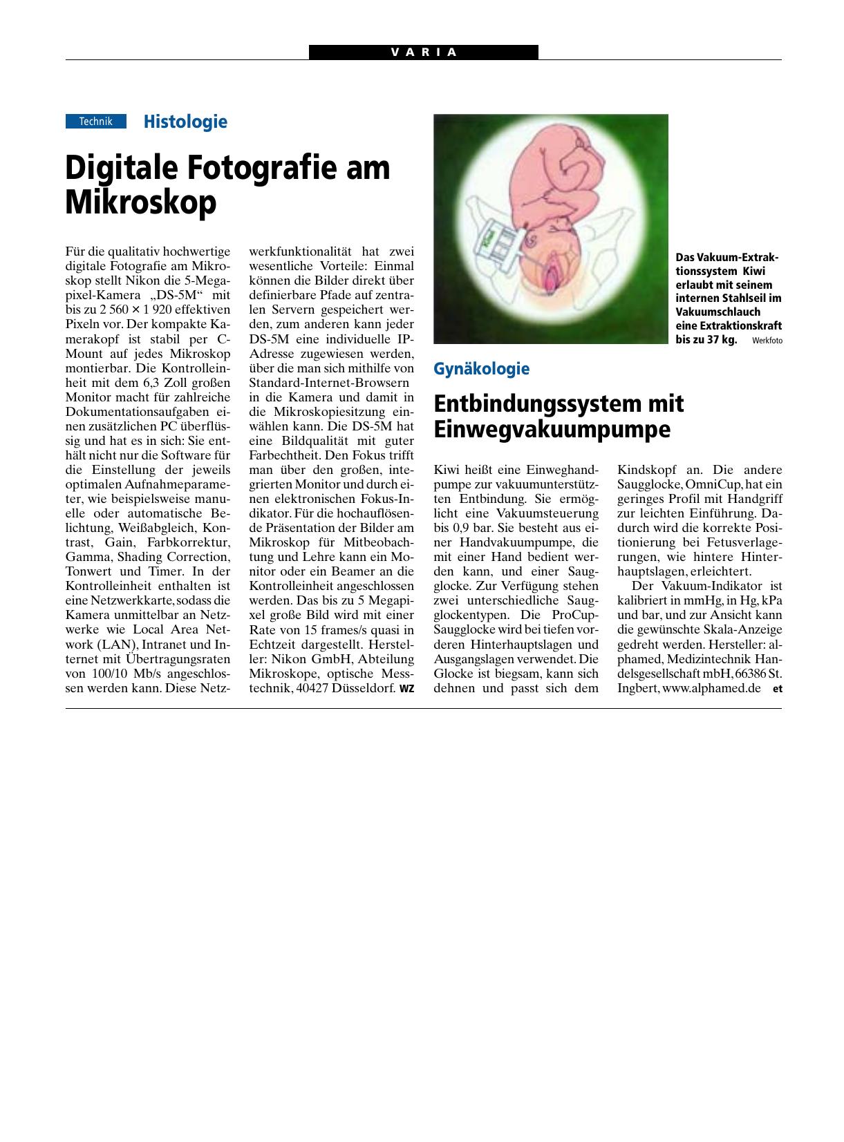 Vorschauseite 1: Gynäkologie: Entbindungssystem mit Einwegvakuumpumpe