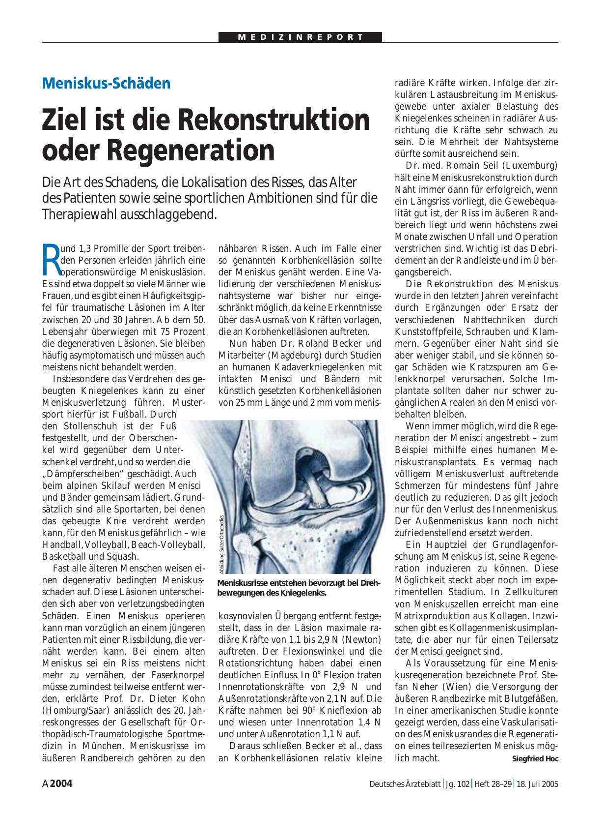Vorschauseite 1: Meniskus-Schäden: Ziel ist die Rekonstruktion oder Regeneration