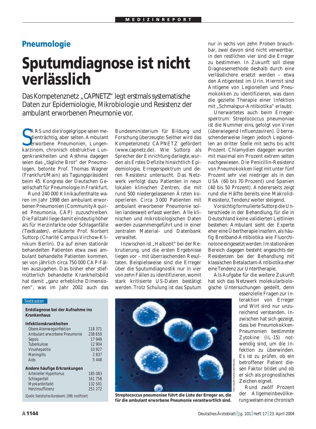 Vorschauseite 1: Pneumologie: Sputumdiagnose ist nicht verlässlich