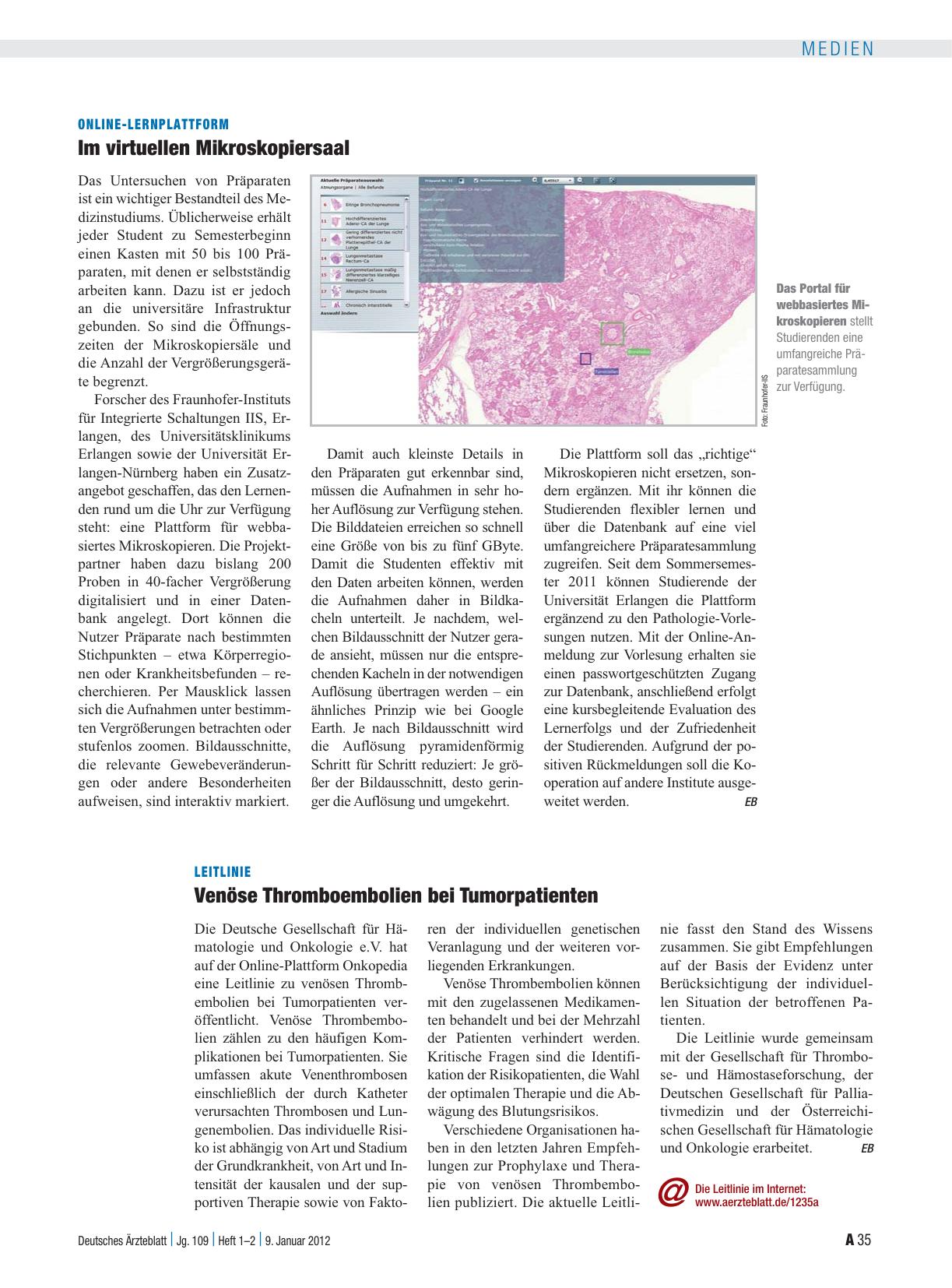 Vorschauseite 1: Leitlinie: Venöse Thromboembolien bei Tumorpatienten