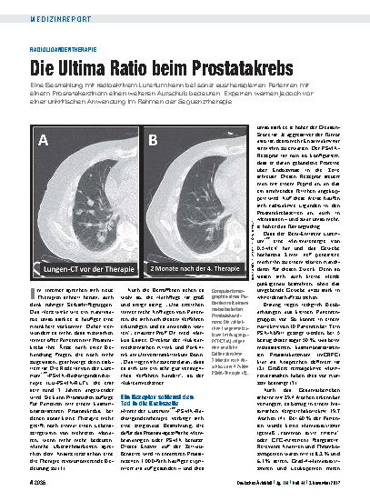 Vorschauseite 1: Radioligandentherapie: Die Ultima Ratio beim Prostatakrebs