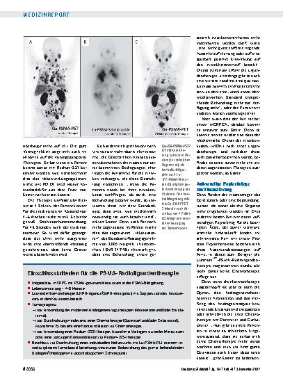 Vorschauseite 2: Radioligandentherapie: Die Ultima Ratio beim Prostatakrebs