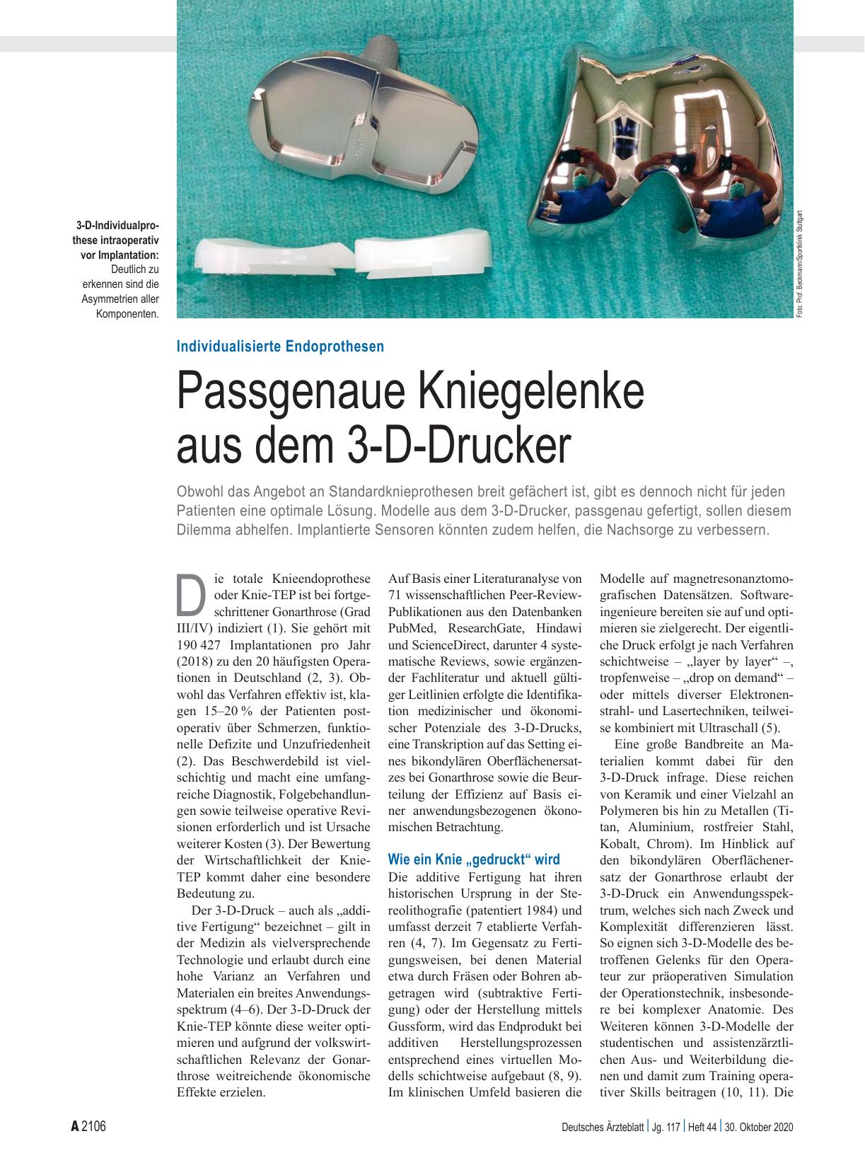 Vorschauseite 1: Individualisierte Endoprothesen: Passgenaue Kniegelenke aus dem 3-D-Drucker