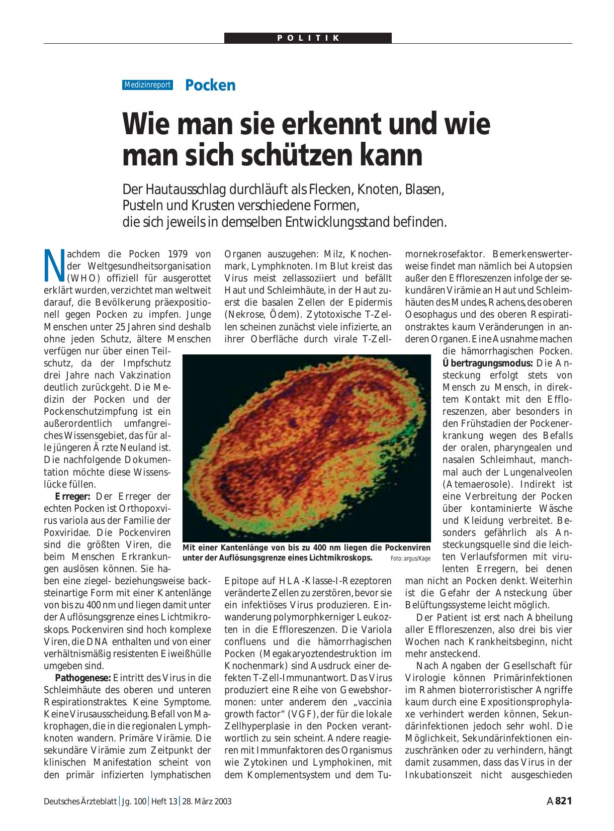 Vorschauseite 1: Pocken: Wie man sie erkennt und wie man sich schützen kann