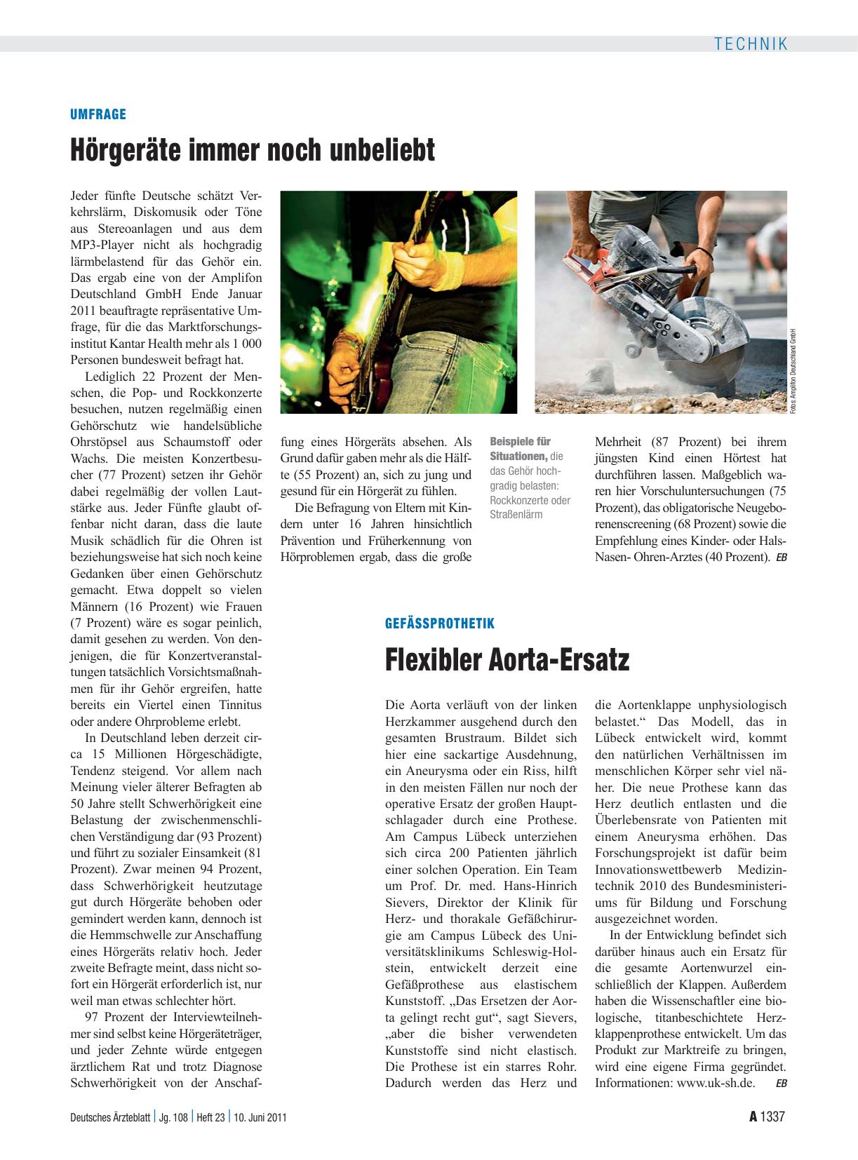 Vorschauseite 1: Gefäßprothetik: Flexibler Aorta-Ersatz