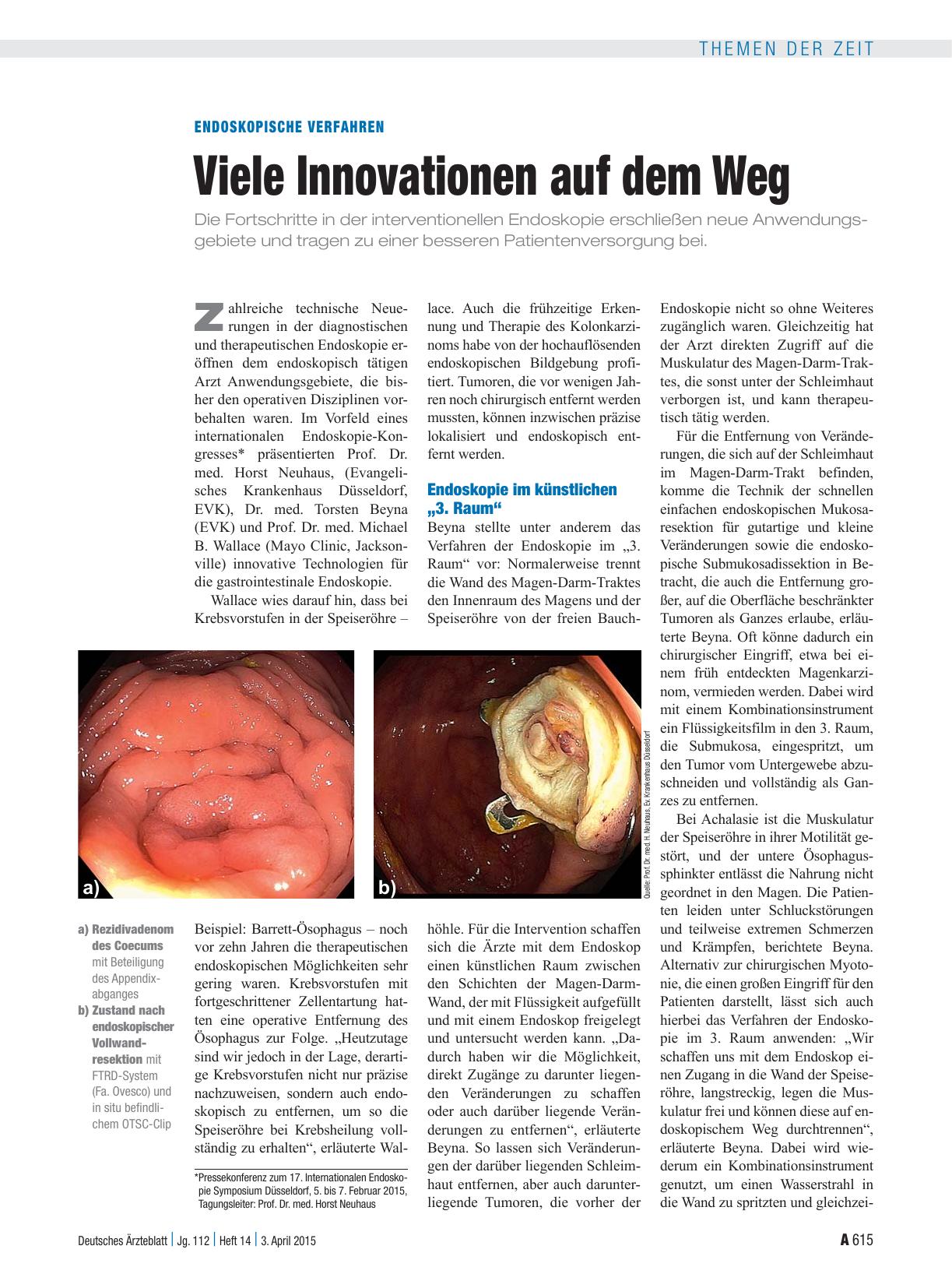 Vorschauseite 1: Endoskopische Verfahren: Viele Innovationen auf dem Weg
