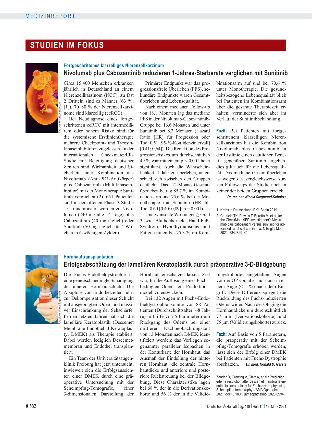 Vorschauseite 1: Hornhauttransplantation: Erfolgsabschätzung der lamellären Keratoplastik durch präoperative 3-D-Bildgebung