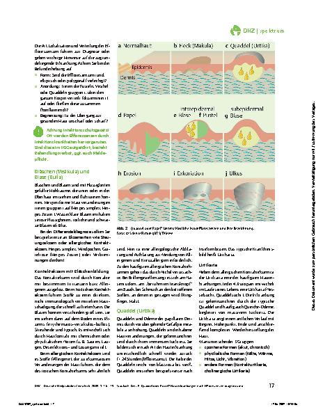 Vorschauseite 2: Quaddel oder Pustel? Hauterkrankungen nach Effloreszenzen diagnostiziert