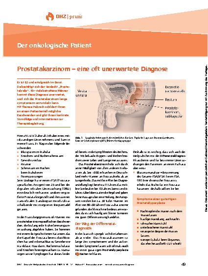 Vorschauseite 1: Prostatakarzinom – eine oft unerwartete Diagnose