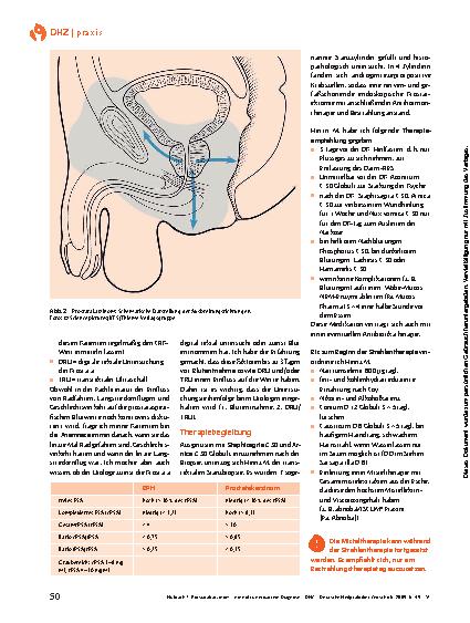 Vorschauseite 2: Prostatakarzinom – eine oft unerwartete Diagnose