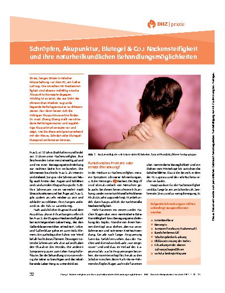 Vorschauseite 1: Schröpfen, Akupunktur, Blutegel & Co.: Nackensteifigkeit I und ihre naturheilkundlichen Behandlungsmöglichkeiten