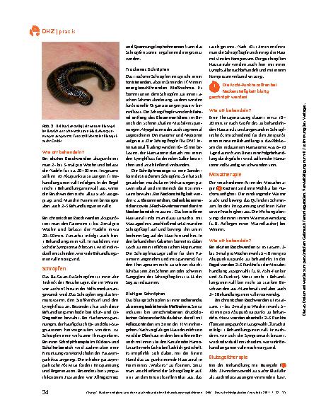 Vorschauseite 3: Schröpfen, Akupunktur, Blutegel & Co.: Nackensteifigkeit I und ihre naturheilkundlichen Behandlungsmöglichkeiten