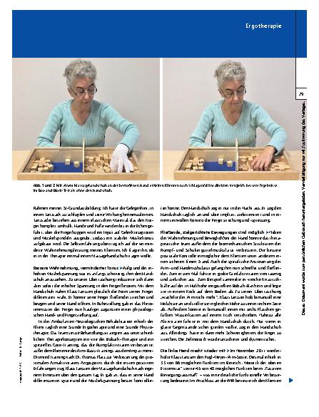 Vorschauseite 2: Fallbericht Hemiplegie – Peelinghandschuh verbessert Therapieerfolg
