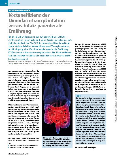 Vorschauseite 1: Chronisches Darmversagen – Kosteneffizienz der Dünndarmtransplantation versus totale parenterale Ernährung