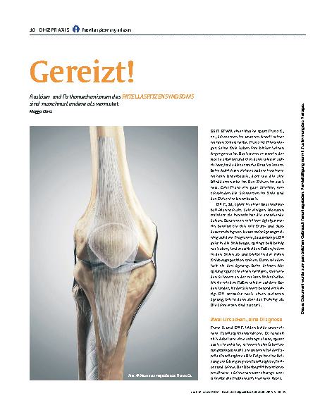 Vorschauseite 1: Gereizt!