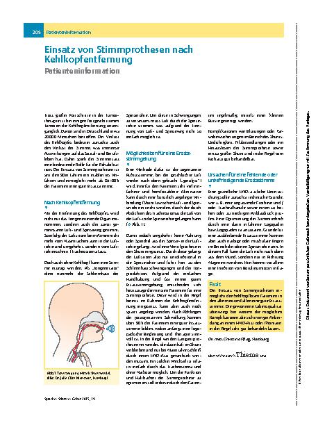 Vorschauseite 1: Einsatz von Stimmprothesen nach Kehlkopfentfernung