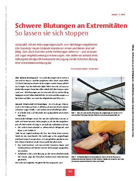 Vorschauseite 2: Schwere Blutungen an Extremitäten - So lassen sie sich stoppen
