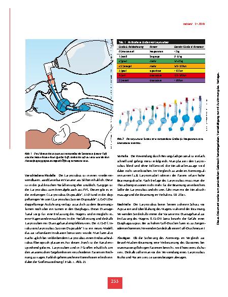 Vorschauseite 2: Schritt für Schritt: Larynxtuben anwenden