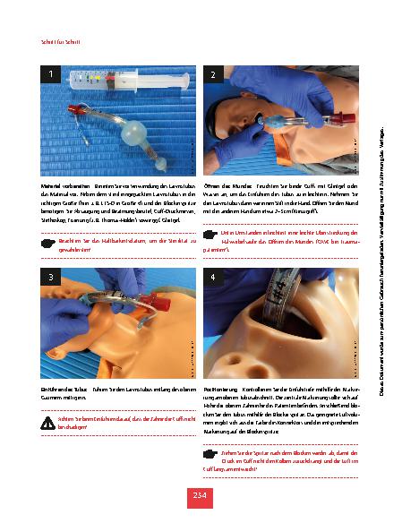 Vorschauseite 3: Schritt für Schritt: Larynxtuben anwenden
