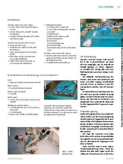 Vorschauseite 3: Das Hirnaneurysma