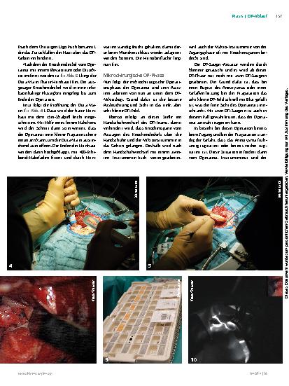 Vorschauseite 5: Das Hirnaneurysma