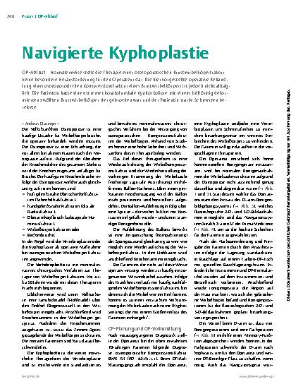 Vorschauseite 1: Navigierte Kyphoplastie